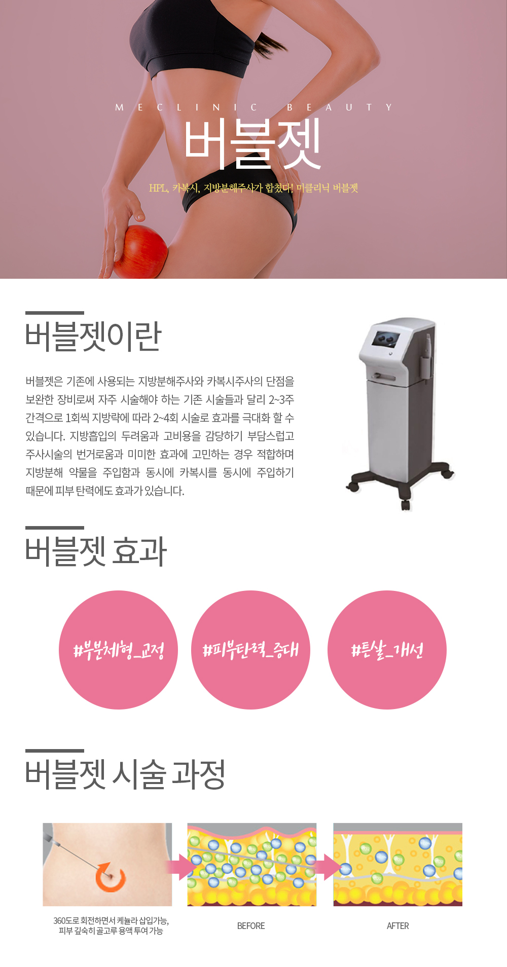 버블젯 컨텐츠
