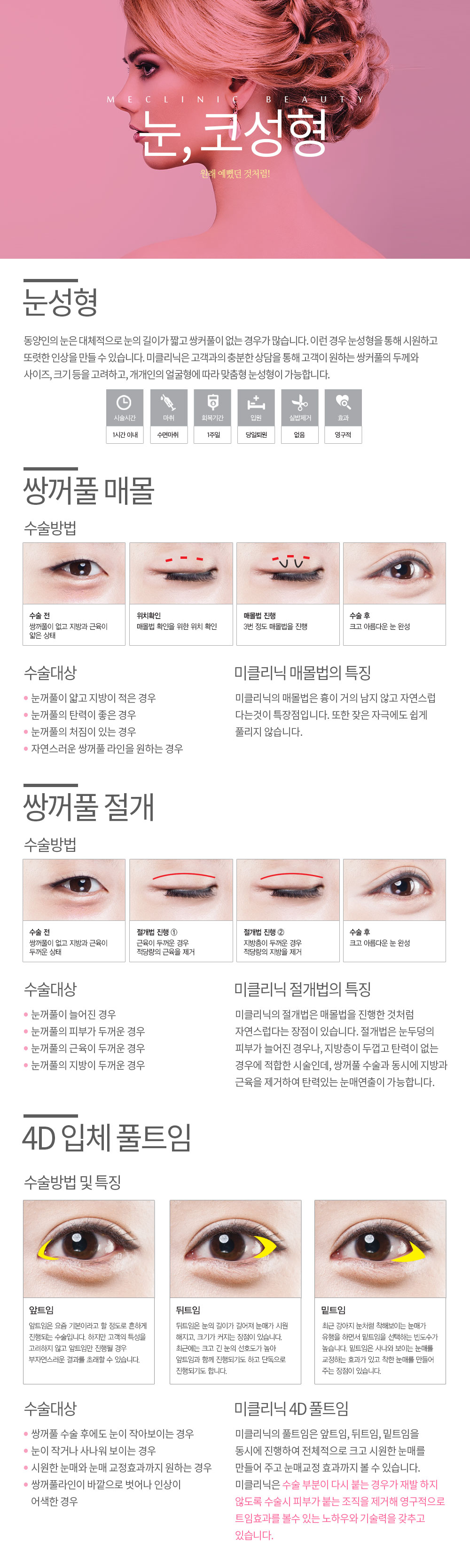 눈코성형 컨텐츠